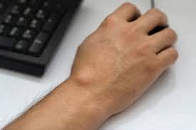 Ganglion Cyst: Benjolan Jinak Tapi Bikin Cemas? Ini Fakta dan Pengalaman Saya
